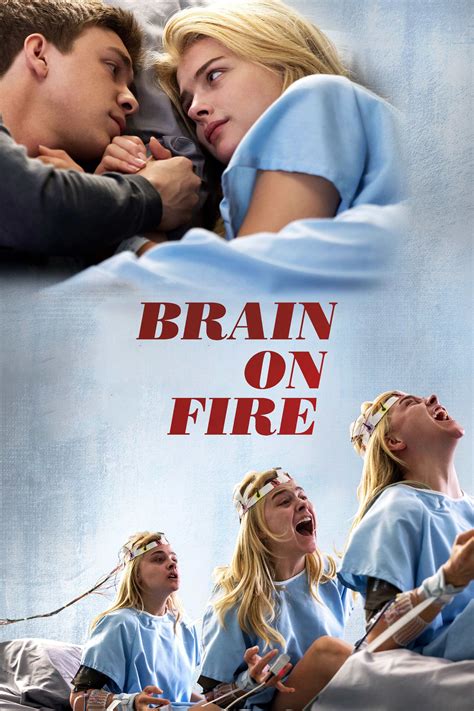 release Brain on Fire